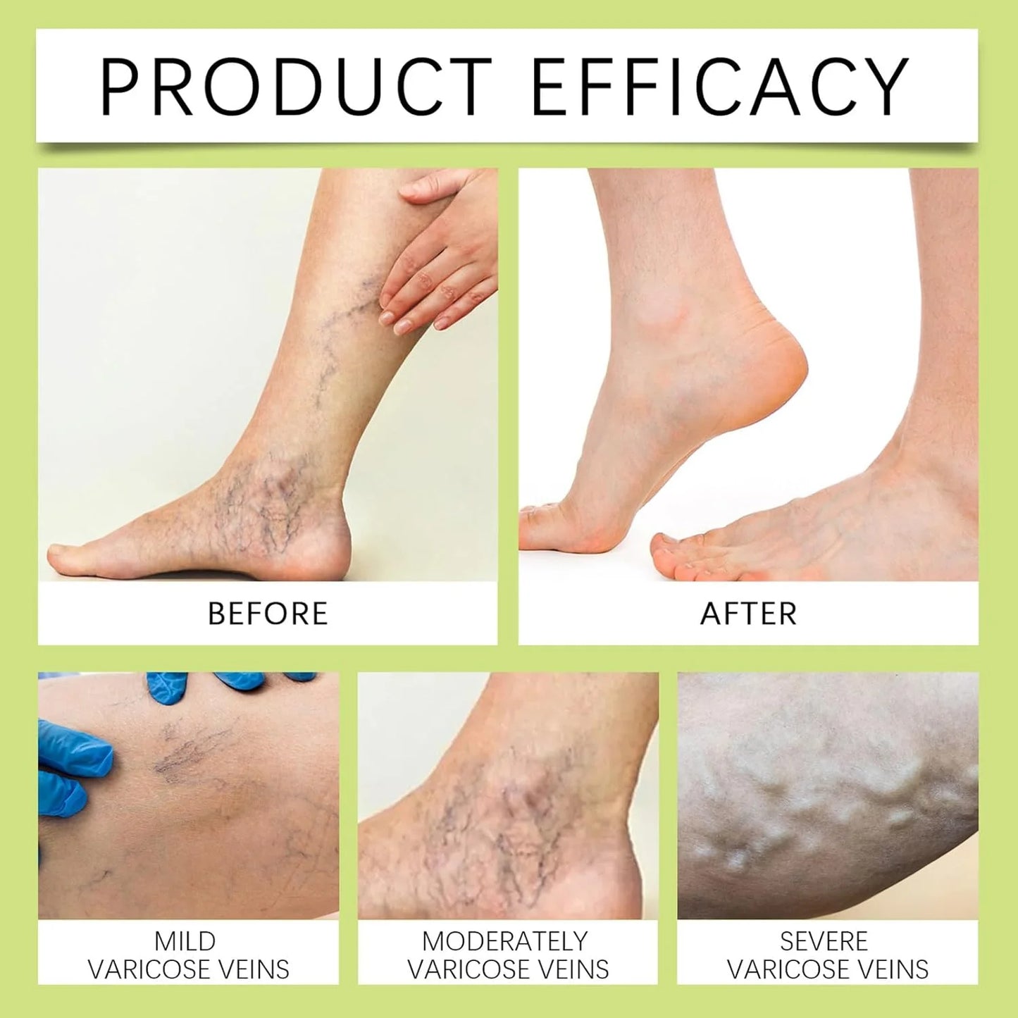 Soothing & Relaxing Joint Cream, Balm for Swollen Legs, Organic Miracle Balm - Natural Ingredients, Soothing Joint Cream for Back, Hands, Feet and Body